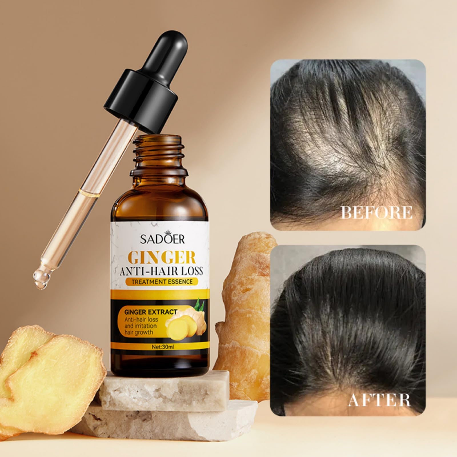 Ginger Care Oil Hair Loss Growth Brilliant Roots
